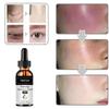 Removing Dark Spot Whitening Cream, Freckles Face Cream, Remove Melasma Remove Dark Spots Cream, Lightening Remover Brightening