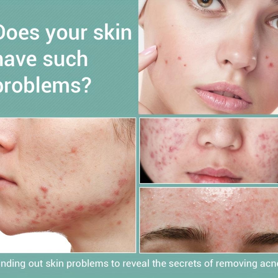 Увлажняющий крем для лица против морщин и тонких линий, укрепляющий крем для глаз