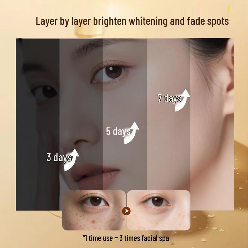 Yilianhua Qizibai Whitening Spot Removal Cream
