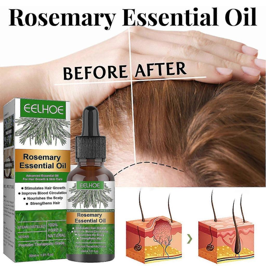 Eelhoe Hair Regenerating Essence 30ml, Scalp Care, Prevents Split Ends, Repairs Damaged Hair, 11x3x3cm