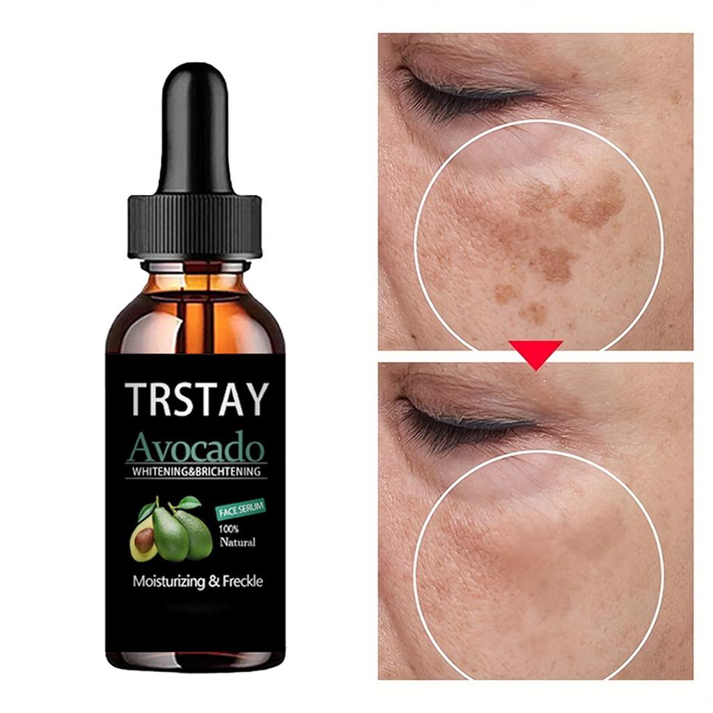 5ML/15ML/30ML/50ML/TRSTAY Dark Spot Serum Hyaluronic Acid Whitening Vitamin C, Face Serum Turmeric Collagen, Facial Skin Care Beauty