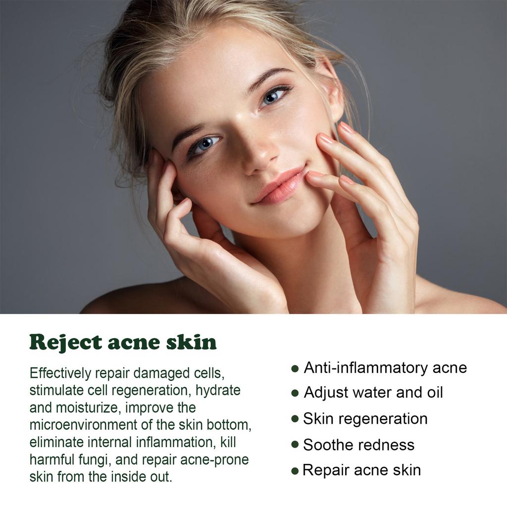 EELHOE Tea Tree Acne Repair Essence Осветляет следы от прыщей Очищает прыщи Устраняет прыщи Восстанавливает кожу Увлажняющая эссенция