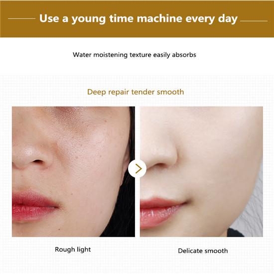 30 шт./бутылка, капсулы с гиалуроновой кислотой, эссенция, отбеливающий крем для удаления пятен, антивозрастная увлажняющая сыворотка для лица, уход за лицом