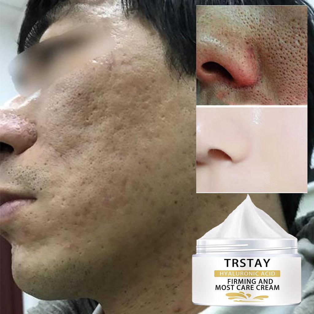 Moisturizing Cream Is Gentle and Non Irritating, Moisturizing, Nourishing, Brightening the Skin, and Removing Pores