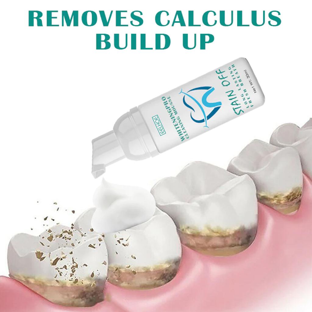 EELHOE Очищение зубов, отбеливающий мусс, зубная паста для глубокой очистки, пена, зубная паста удаляет пятна, свежее дыхание, инструменты для ухода за зубами, 30 мл