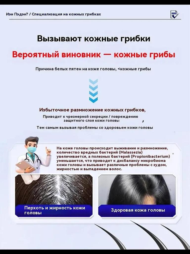 Ringworm Capitis and Scalp Special Spray Fungal Infection Dandruff Itching