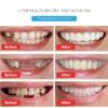 Silicone Simulated Teeth Veneer Smile Simulation Flex Denture Veneer Cosmetic Teeth Cover Whitening