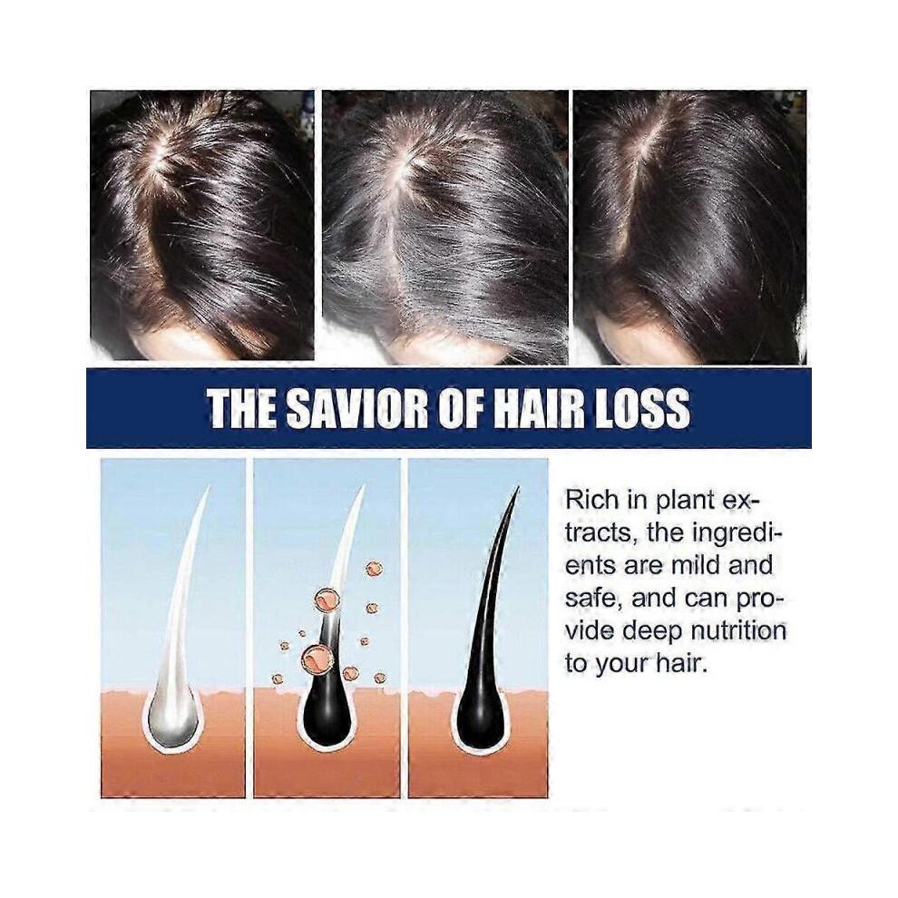(2 pcs)1-3x New Alopecia Cream Growing Alopecia Baldness Regrowth 20g