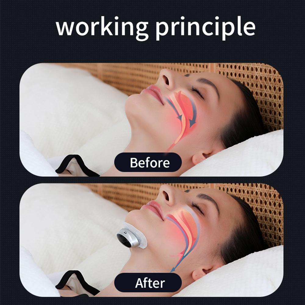 Smart Anti-snoring Device Portable Breathing Corrector EMS Dual Pulse Muscle Stimulator Relieve Snoring Anti Snoring Stop Snore