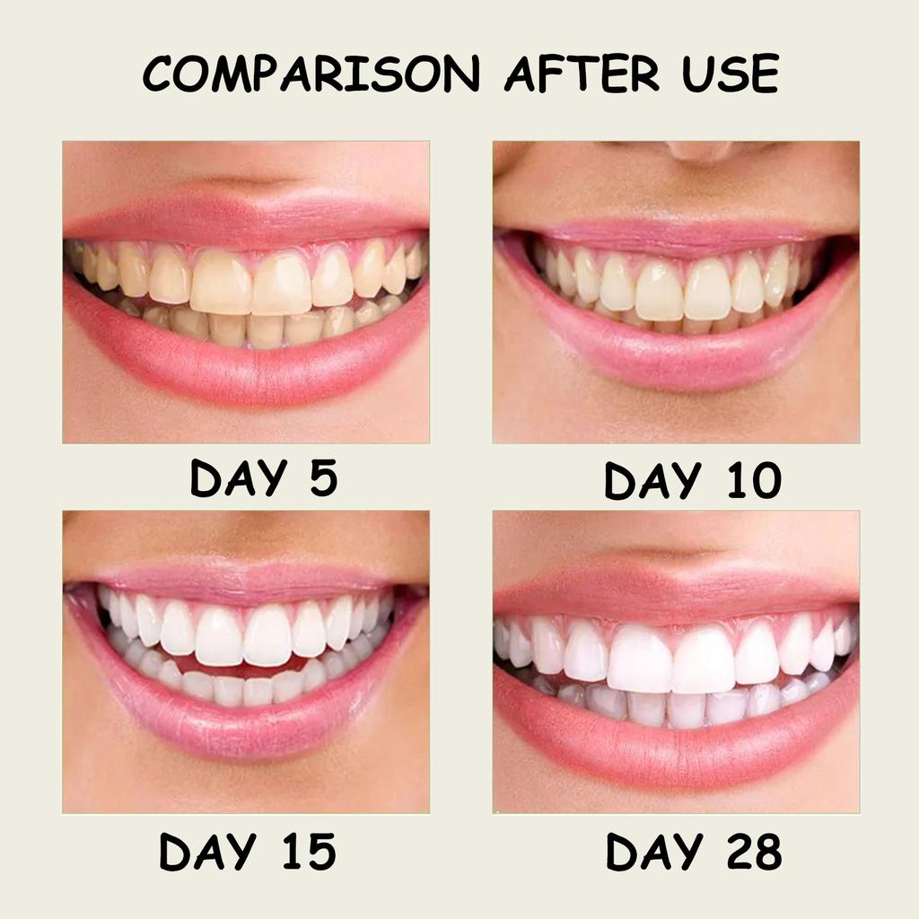 Зубная паста с ксилитом и мятой, средство для удаления желтых пятен на зубах, гигиена полости рта, чистка зубов, отбеливание зубов, свежее дыхание, уход за зубами