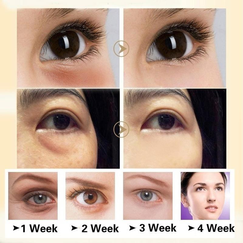 Самый эффективный отбеливающий уход за кожей против морщин Крем с конским маслом Омолаживающий, против морщин Крем для лица Эссенция для глаз Удалить темные круги Крем для глаз