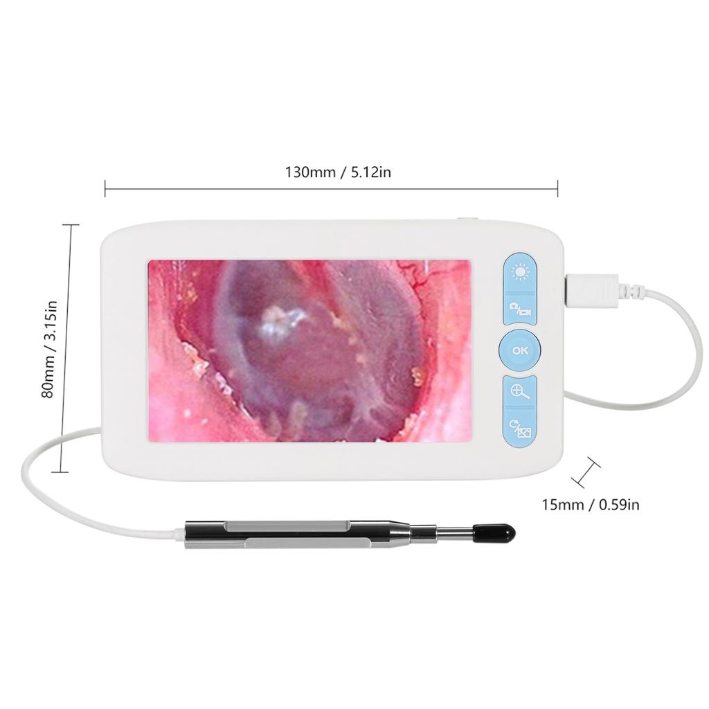 Digital Otoscope with 6 LEDs Lights 32G TFcard 3.9mmm 1080P High Definition Ear Scope Camera 4.3in IPS Screen Earwax