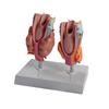 Патологическая анатомическая модель щитовидной железы со съемными частями Патологическая анатомическая модель щитовидной железы и гортани для изучения заболеваний