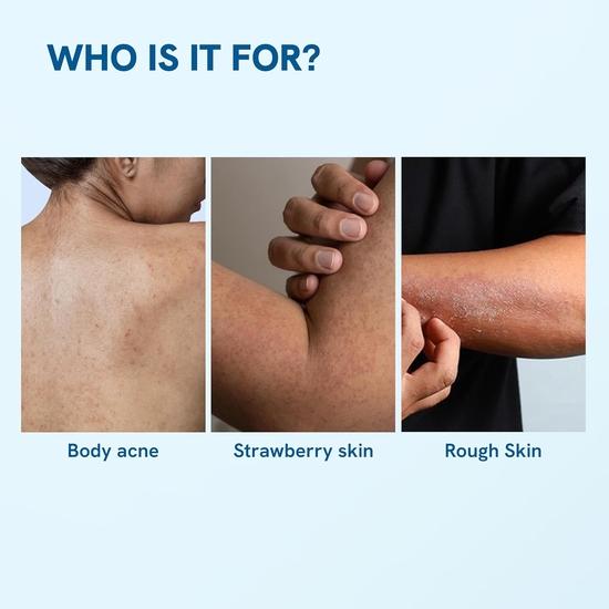 Гель для душа Be Bodywise с 1% салициловой кислотой 500 мл | Помогает предотвратить появление прыщей на теле и очищает кожу | Не содержит парабенов и SLS | Упаковка из 2 шт.