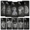 Chalkboard Anatomy Phone Case For Xiaomi Redmi Note 13 12 5G 11 10 Pro 4G Plus 9S 9 8 7 9T 8T 10C 9C 9A 5G Soft Silicone Cover