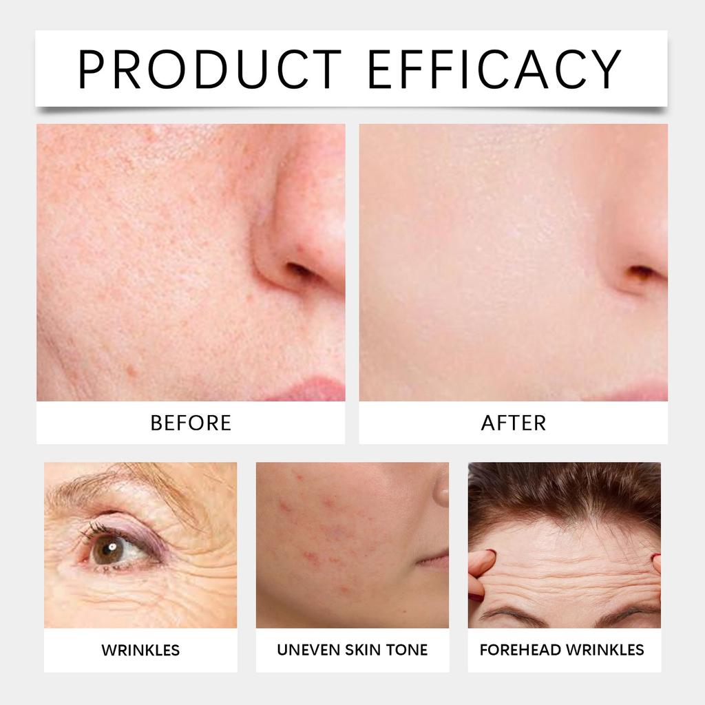 Snake Night Cream Daily Facial Care Deep Nourishing Facial Skin Delicate And Smooth