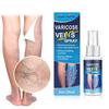 Yousheng 30ML Varicose Vein Massage Spray Relieve Leg Discomfort Improve Circulation Gentle Effective Varicose Spray