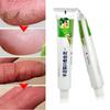 Powerful Hand Foot Crack Cream Heel Chapped Peeling Skin Care Chinese Ointment