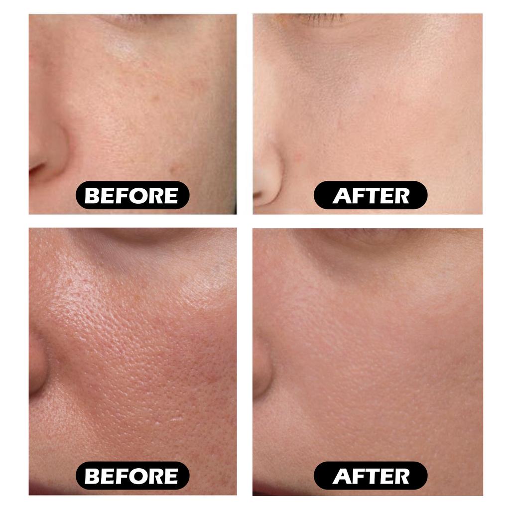 Facial Instant Moisturizing Serum, Hydrating And Moisturizing, Fading Wrinkles, Firming And Brightening Serum