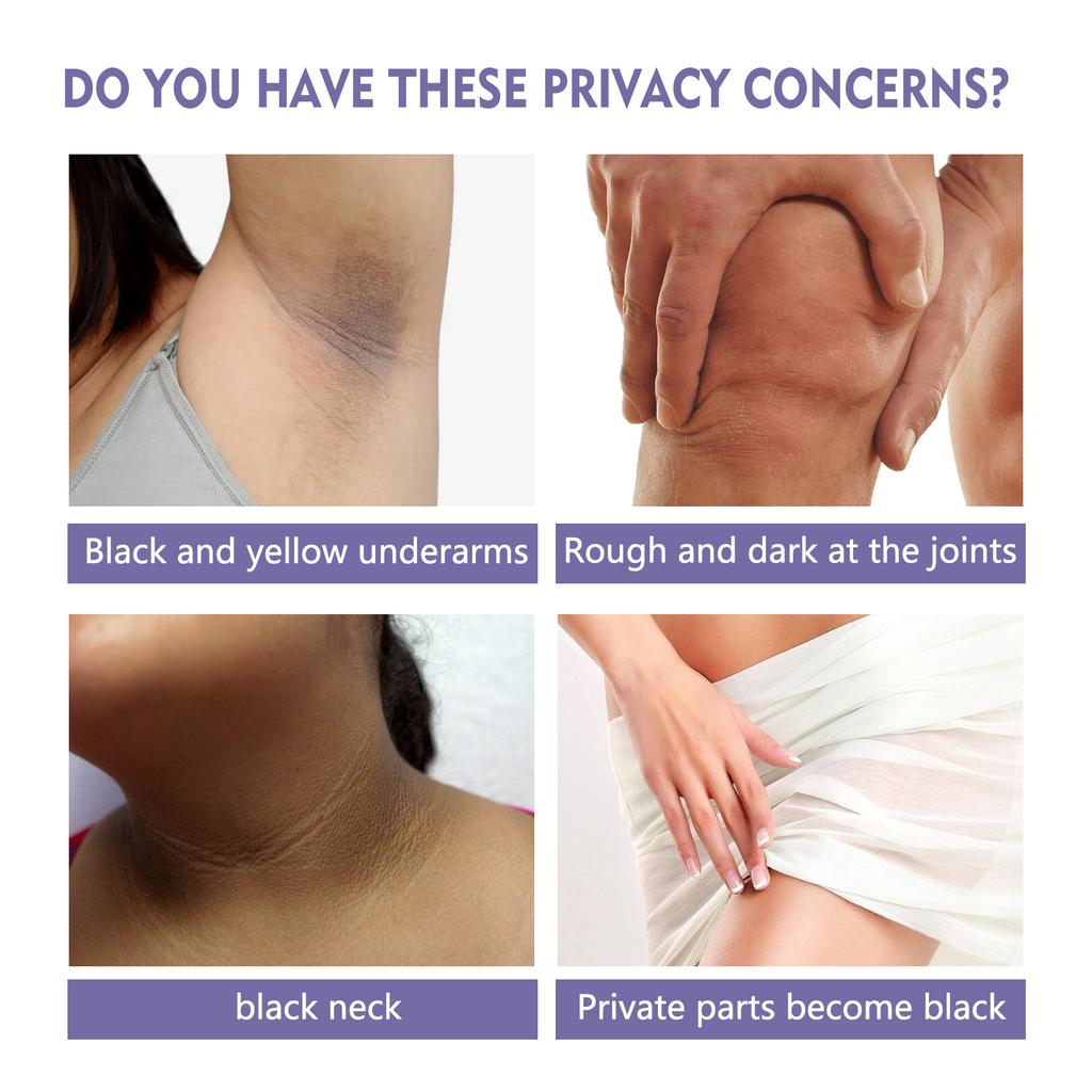 EELHOE Body Whitening Stick Underarm Knee Buttocks Private Bleach Remove Melanin Pigmentation Improve Dull Nourish Brighten Skin Care