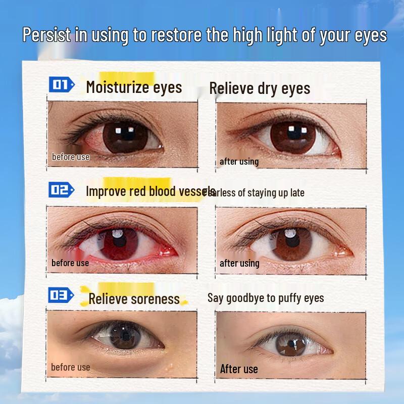 Ruyi Lutein Eye Relief Spray