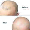 Men'S Convenient Multi-Blade Shaver Effortless Bald Head & Body Hair Grooming For Unisex Washable Shave Clean In One Strok