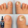 5 мл/15 мл/30 мл/50 мл/Crazylife Hand And Foot Nail Onycho Repair Nail Onychomycetant для утолщения ногтей, подавитель