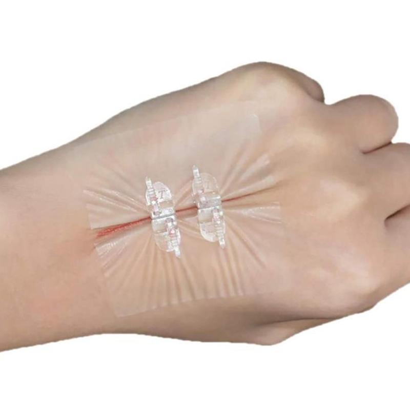 Безболезненный шовный клейкий пластырь для закрытия ран, быстрый кровоостанавливающий бандаж