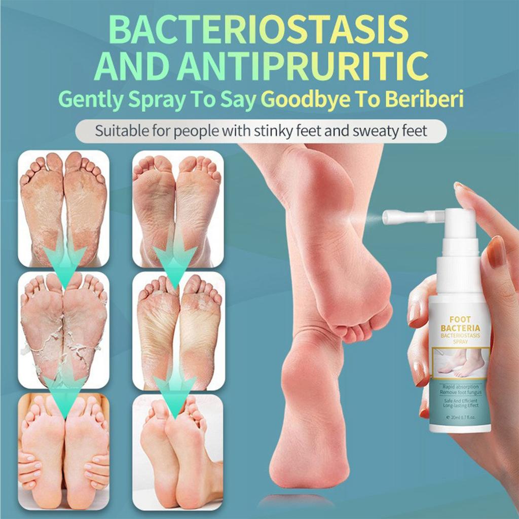 Быстродействующее средство для ухода за ногами при грибке стопы, Натуральный дезодорант для ухода, Освежающий и дезинфицирующий спрей для женщин, 20 мл