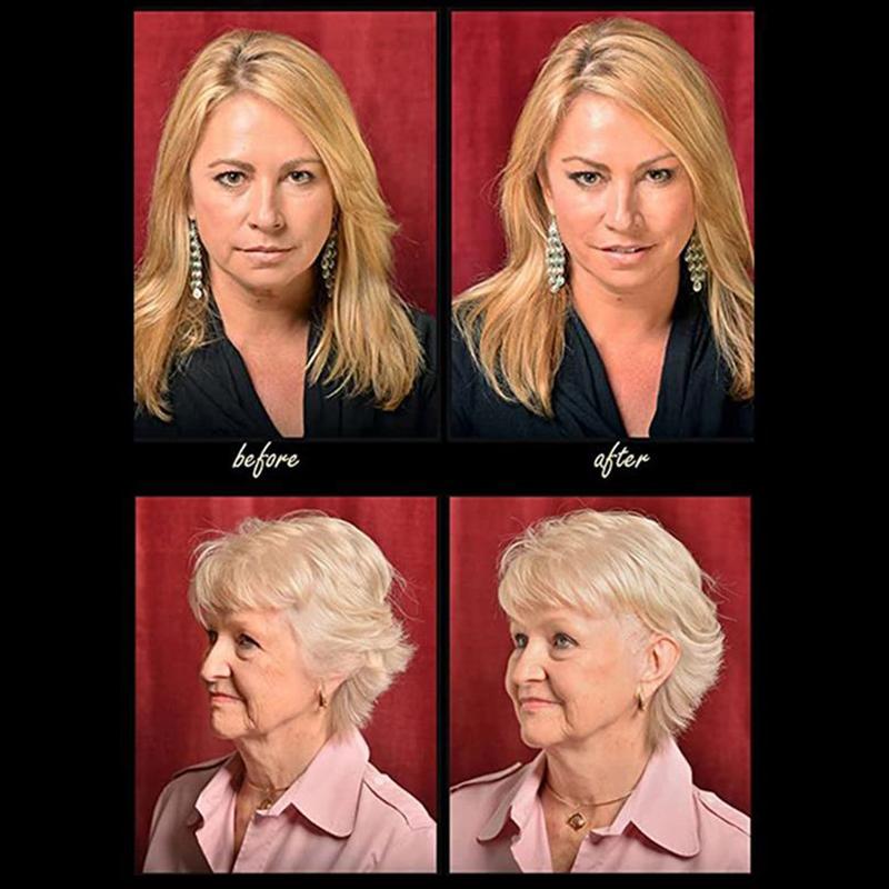 Мгновенная подтяжка лица, удаление морщин «рыбий хвост» вокруг глаз, многоразовая подтяжка лица