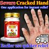 Natural Herbs Repair Salve for Cracked Hands & Feet - Gentle Non-Irritating