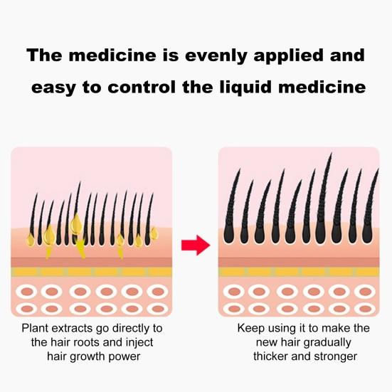 8ML Hair Oil Applicator with Precise Scale Scalp Massage Applicator Comb Clear Portable Hair Serum Oiling Dispenser Brush Hair Root Application Comb