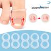 New Toe Inlaid Nail Ring Stretching Rebound Nail Groove Curl Physical Stretching Can Walk, Can Be Washed and Reused