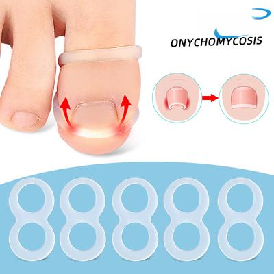 Новое кольцо для ногтя с инкрустацией на пальце ноги, растягивающееся, отскакивающее, для выпрямления ногтевой бороздки, физическое растяжение, можно ходить, можно мыть и использовать повторно