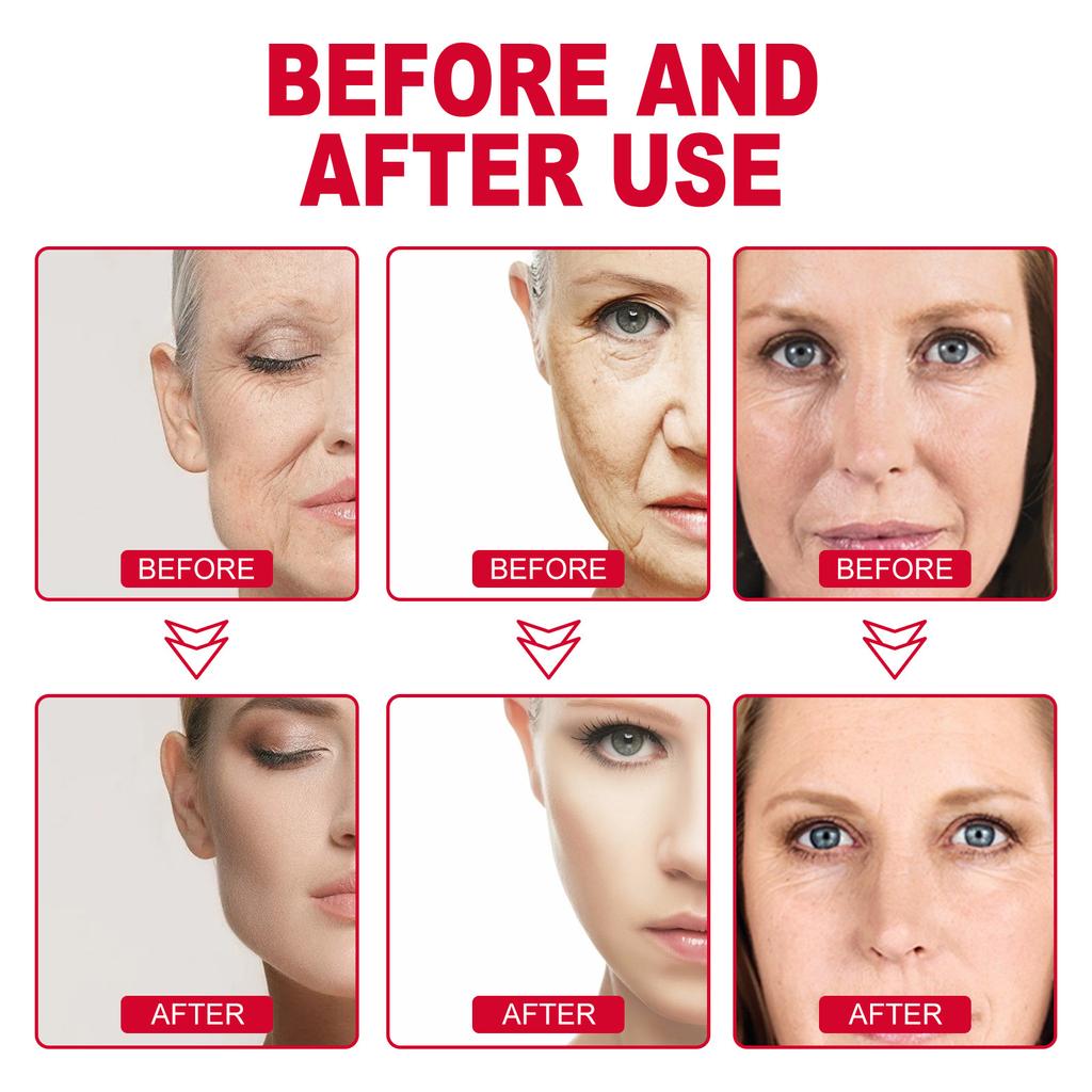 EELHOE Retinol Remove Dark Circles Eye Serum Eye Bags Lift Firm Brightening Eye Cream Hyaluronic Acid Anti-Wrinkle Massage Eyes Care