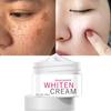 Facial Freckle Milk 30ml Facial Body Black Spot Correction Elderly Spotted Black Spotted Creams Dilute Pigment Freckle