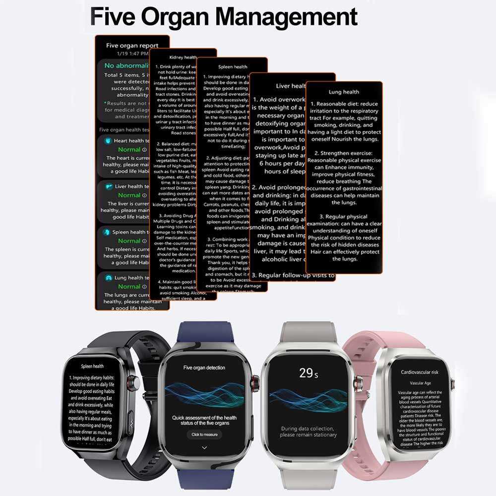SmartWatch Voice Call Push Reminder Physical Examination Health Watch Blood Pressure UricAcid Blood Oxygen ECG Sport Smart Watch