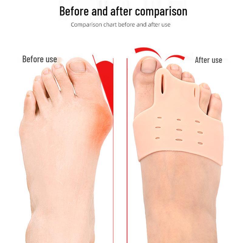 Silicone Hallux Valgus Corrector & Toe Separator with Shock Absorber