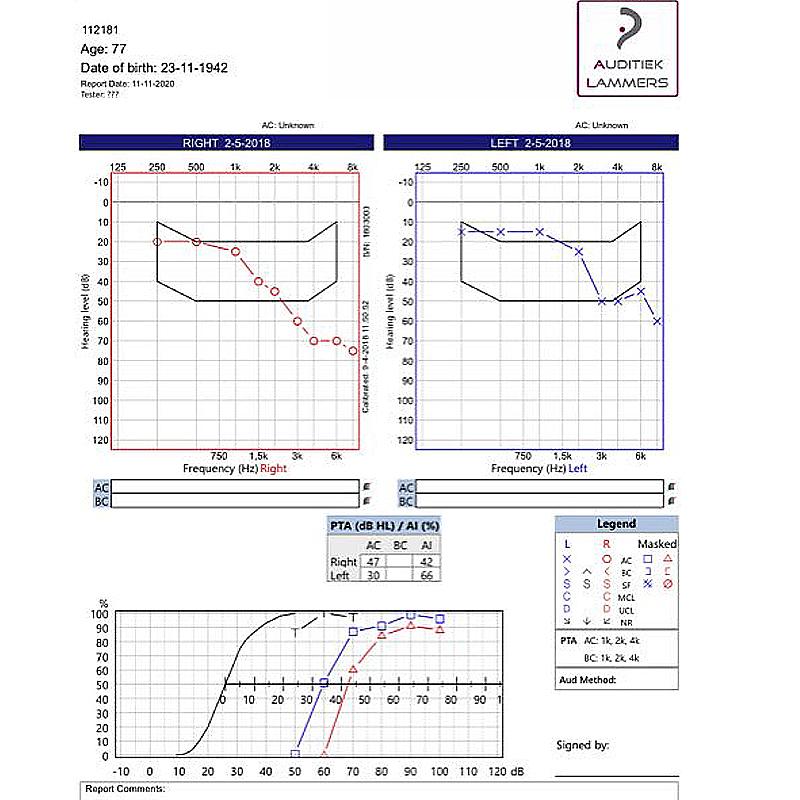 G-26 Перезаряжаемые мощные цифровые 8-канальные слуховые аппараты Усилители звука Беспроводные слуховые аппараты для пожилых людей