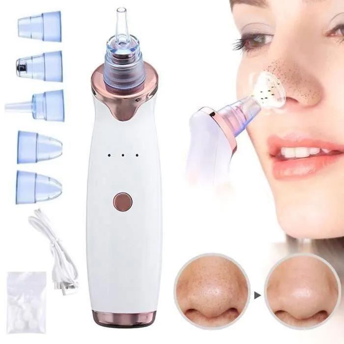 My Little Gifty Aspirateur à Points Noirs Aspirateurs Imperfections
