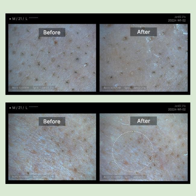 Medicube [Vegan] Super Cica Deep Cleansing Balm 100 Ml / 3.38 Fl. Oz. (3 Options)