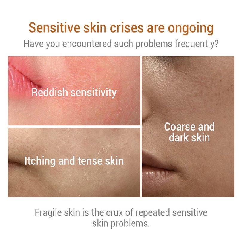 Эктоиновая сыворотка для лица, восстанавливающая покраснение, эссенция для ухода за чувствительной кожей, сужающая поры, увлажняющая и успокаивающая 30 мл