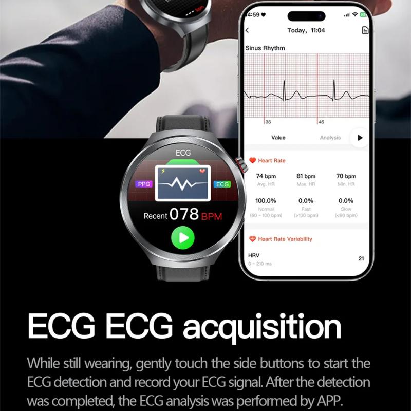 2025 New ECG+PPG Smart Watch Lipids Uric Acid Blood Pressure Health Watch Men NFC Access 100+Sport HD Bluetooth Call Clock Women