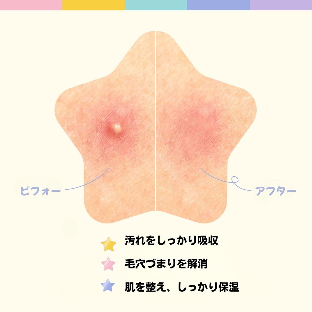 Star Spot Patches for Cute Pastel Made In 80 Patches #OOTD Face, Hydrocolloid, Niacinamide, Ceramide, Colors, Transparent, Korea,