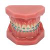 Dental Orthodontic Model 28pcs Teeth Resin Dental Teaching Teeth Model with Metal Braces