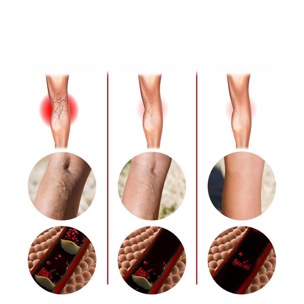 Крем для нормализации цвета кожи на ногах - 1 шт.
