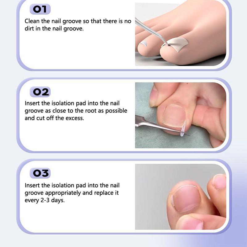 Крючок для ухода за вросшими ногтями, двухсторонний, для коррекции вросших пальцев ног, пилка для маникюра и педикюра, инструмент для ухода за чистыми ногтями ног