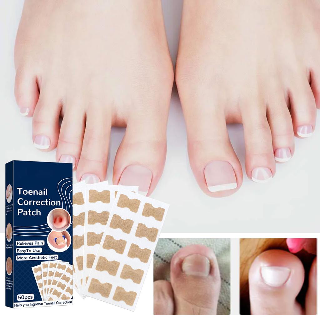 Ingrown Toenail Correction Stickers, Glue-free Ingrown Toenail Corrector Strips, Painless-Pedicure Toenail Corrector, To Nail , 50PCS
