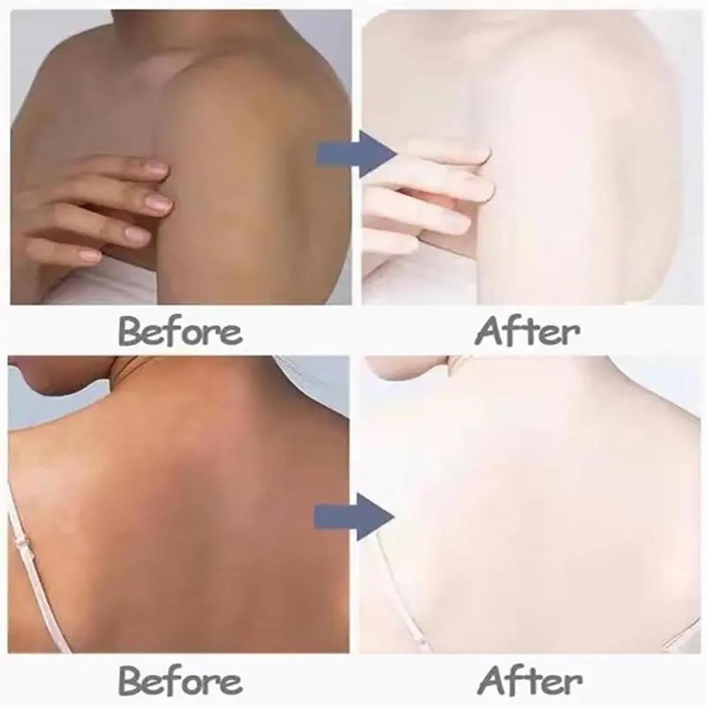 Подмышки Бедра Черный крем для удаления Отбеливание и осветление Разбавление Осветление тона кожи Восполнение влаги