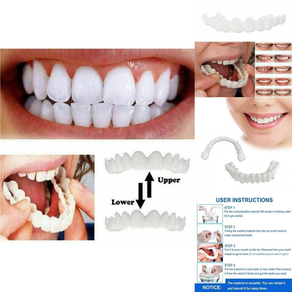 Fake On Snap Teeth Upper Lower Dental Veneers Denture Tooth Cover Set Simulation